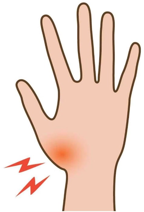 スマホが押せない！深刻な手指の痛みと対策②～親指のつけ根が痛い60代の半数を襲う母指CM関節症